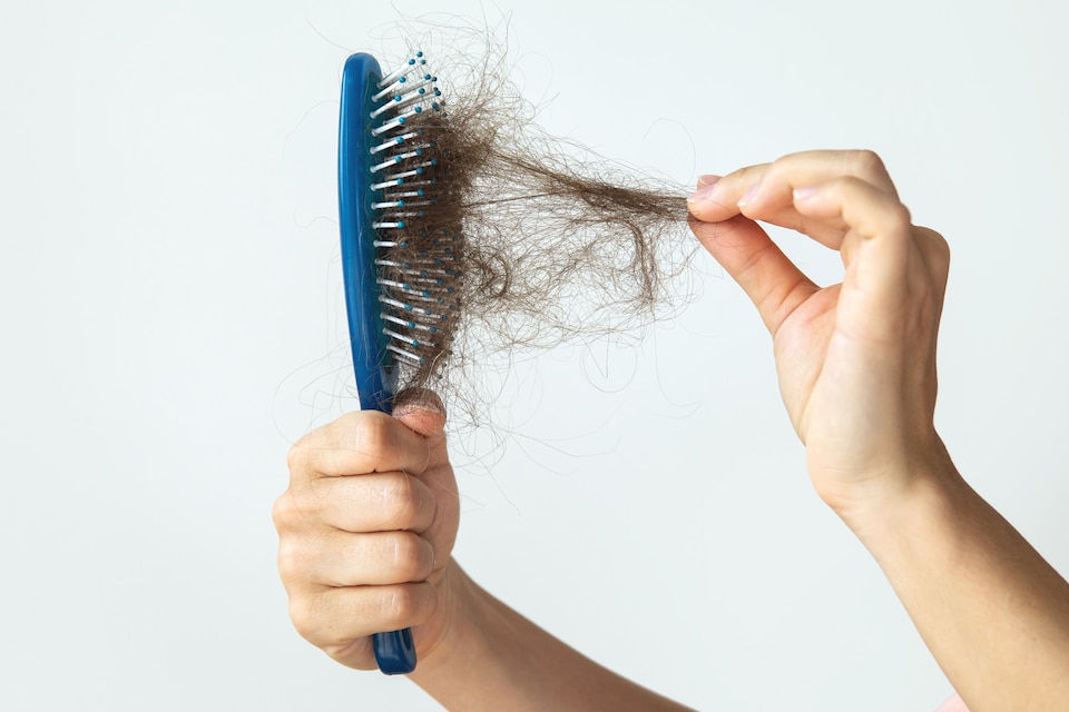 دعنا نساعدك على تلقي علاج تساقط الشعر في ألمانيا