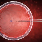 تكلفة الحقن المجهري في المانيا