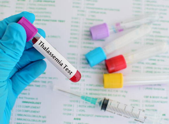 علاج الثلاسيميا في ألمانيا : علاجات مبتكرة وفعّالة