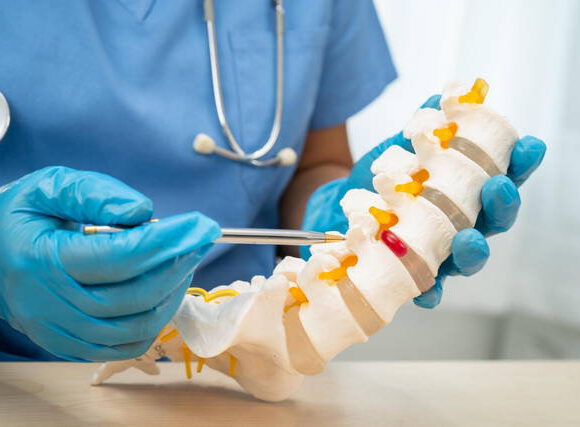 علاج الديسك في المانيا : علاج شامل ومتقدم