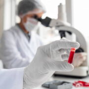 دعنا نساعدك على تلقي علاج الهيموفيليا في ألمانيا