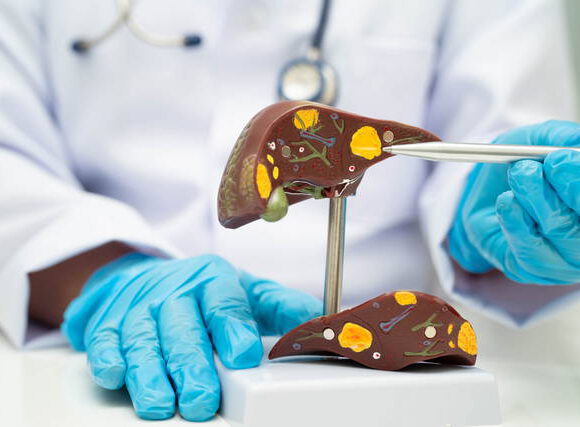 علاج سرطان الكبد في المانيا : علاجات مبتكرة وفعّالة